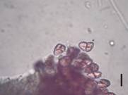 Chondracanthus3